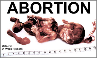 photo of 23 week old fetus
